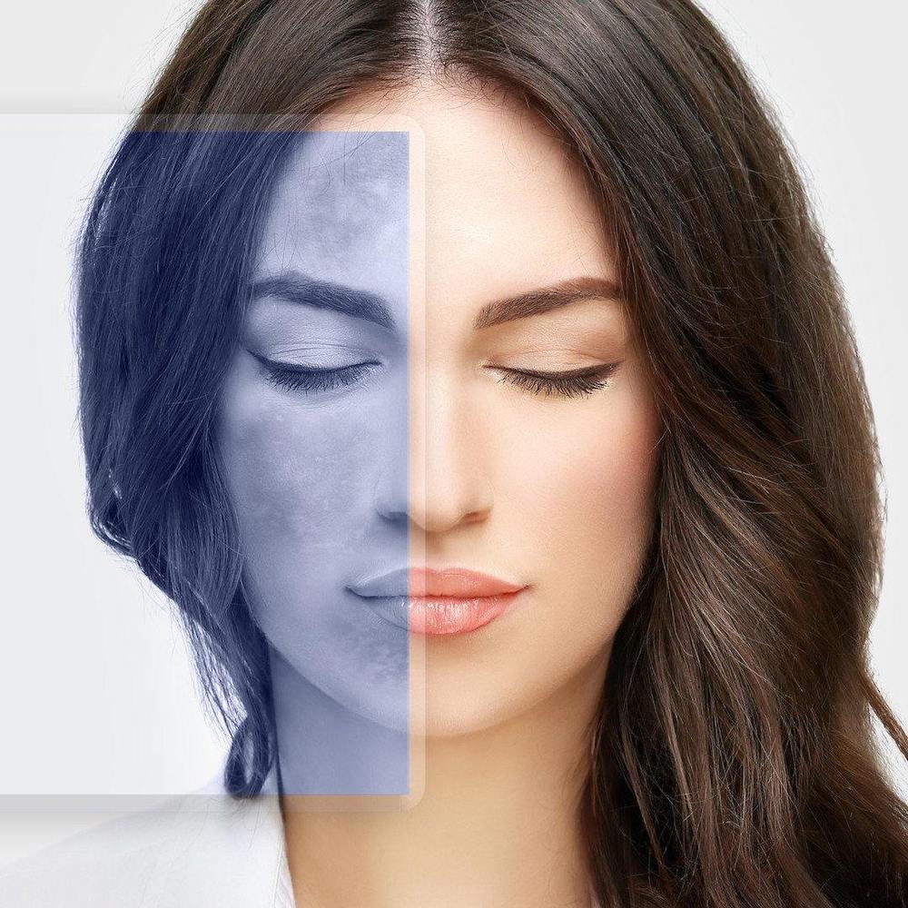 Whitening Facial Cream with Retinol & EAC